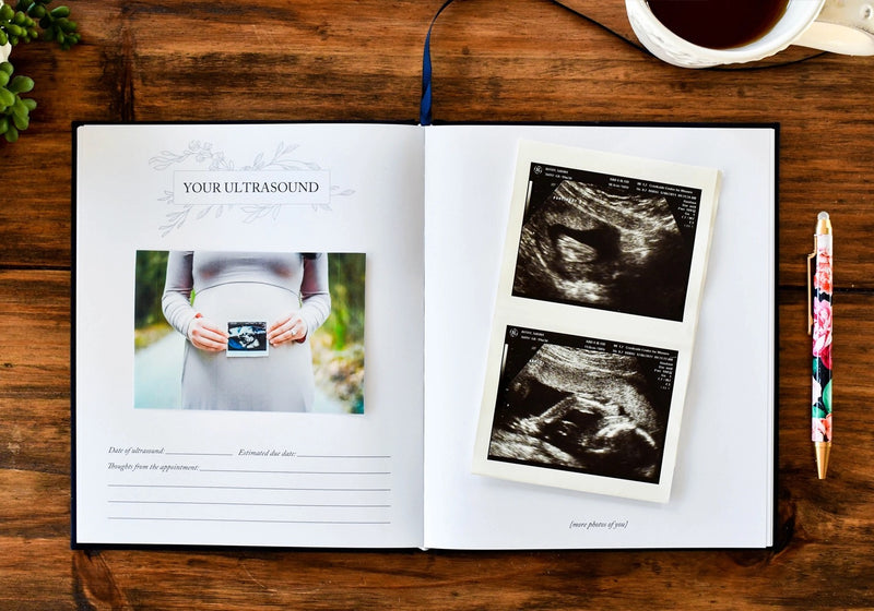BA- Pregnancy Prayer Journal and Memory Book for Moms